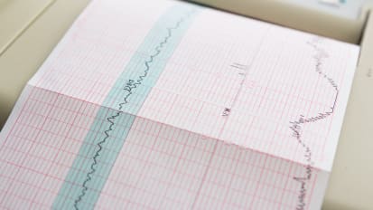 Session 4 - Cases: "What an Interesting Heart!"