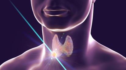 Management of Thyroid Nodules | Penn Medicine