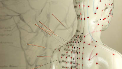 Incorporating Acupuncture