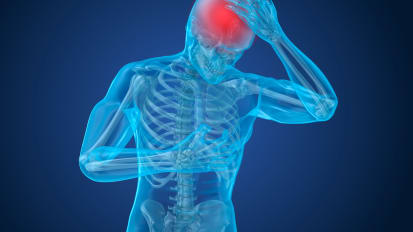 Endovascular Management of Acute Stroke