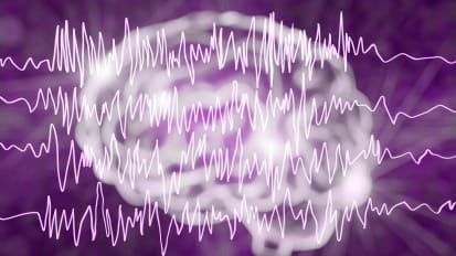 Neuromodulation for Temporal Lobe Epilepsy: Electrical Stimulation and Focused Ultrasound