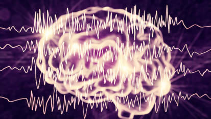 Epilepsy Illuminated: How to Define, Diagnose and Distinguish Seizures