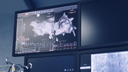 历史、当前和未来进化革命处理