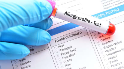 All About Allergies: Successful Diagnosis and Treatment