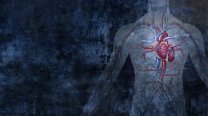 Myocardial Infarction in Non-Obstructed Coronary Arteries (MINOCA) | Podcast with Monika Sanghavi, MD