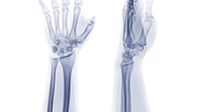 Hand Injuries During a Pandemic 