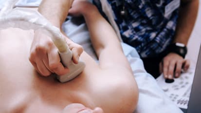 Cardio-Oncology at Penn Medicine