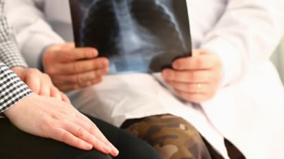 COVID-19 and Cancer: Lung Health and the Cancer Patient