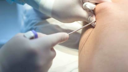 Updates in Sarcoma Management: Local Treatment, Clinical Trials, and the Future of Sarcoma Care