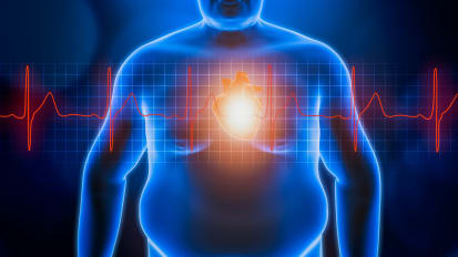 Associations of Obesity and Subtypes of Heart Failure