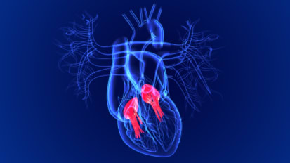 Evaluating the Benefit of Concomitant Tricuspid Repair During Mitral Valve Surgery