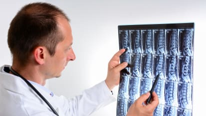 Surgical Treatment of Symptomatic Spondylolysis