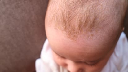 Big, Small, Flat, Triangular: Understanding Abnormal Head Shapes in Infants