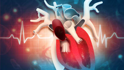 Transforming Care for Aortic Disease | Penn Aorta Center