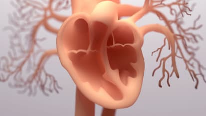 Cardiac Amyloidosis: Contemporary Diagnosis and Therapy