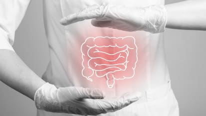 A Brief Overview of Necrotizing Enterocolitis