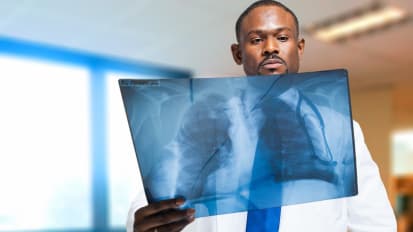 Lung Cancer Screening: Who, How and When to Refer