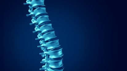 Spinal Tethering