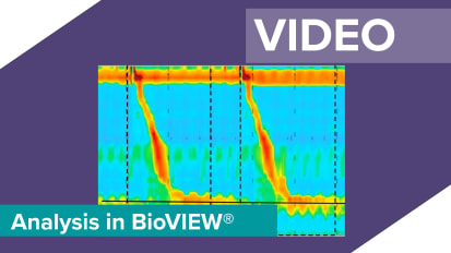 Analysis of an Esophageal Manometry Study using an HRiM Small Diameter Probe