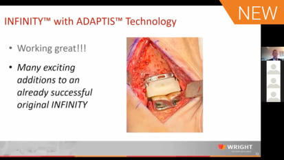 INFINITY™ with ADAPTIS™ Technology with Dr. Robert Anderson and Dr. W. Hodges Davis [AP-014201A]