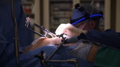 Minimally Invasive Coronary Artery Bypass Graft: MICS CABG Procedure