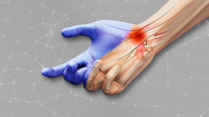 Optimizing the Evaluation and Management of Carpal Tunnel Syndrome and Trigger Finger
