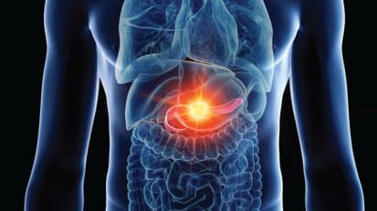 New Advances in the Management of Pancreatic Cancer