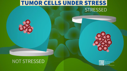 Benefits of Combining Beta-Blocker and Checkpoint Inhibitor