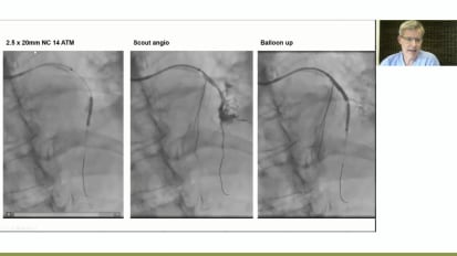 Lifelines for Your Practice: Case-Based Approaches to Perforation Management