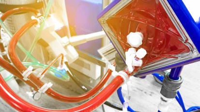 Severe ARDS: Patient Selection for Respiratory ECMO