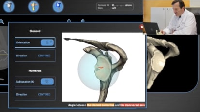 BLUEPRINT™ Tutorial using AEQUALIS™ PERFORM™ with Gilles Walch, MD [CAW-0578]