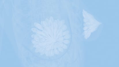 Breast Cancer Screening Guidelines: What You Should Know