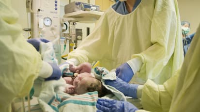 Delayed Cord Clamping for Preterm & Term Infants