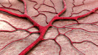 Center volume and hereditary hemorrhagic telangiectasia