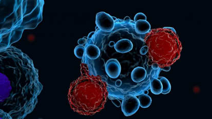 First-in-Human Clinical Trial for B-cell Lymphoma Using “Armored” CAR T Cells Opens at Roswell Park