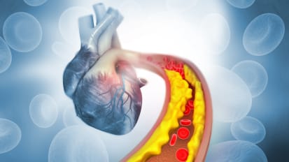 Sentara RMH: Complex Coronary Cases