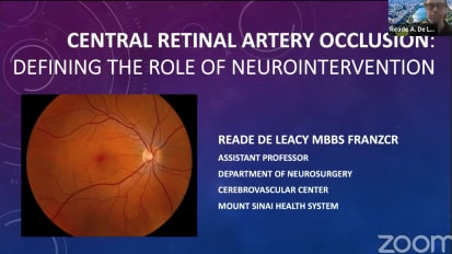 Central Retinal Artery Occlusion: Defining the Role of Neurointervention