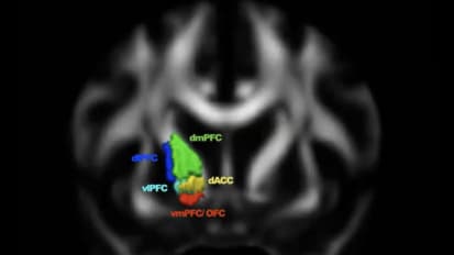 Circuit Therapy for Neuropsychiatric Disorders