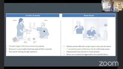 Enhanced Stroke Recovery