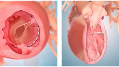 Sean P. Pinney, MD leads Grand Rounds on heart failure