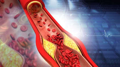 Coronary Physiology Ultrasound