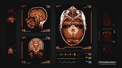 Using magnets to treat major depressive disorder: Clinical trial shows promise