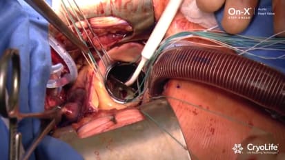 端对端valveAVR程序