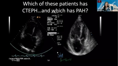 CTEPH Diagnosis and Management in 2022: Grand Rounds with Dr. Anjali Vaidya