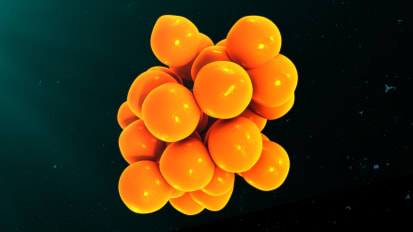Understanding Multiple Sclerosis and How Cytokines Shape Neuroinflammatory Patterns