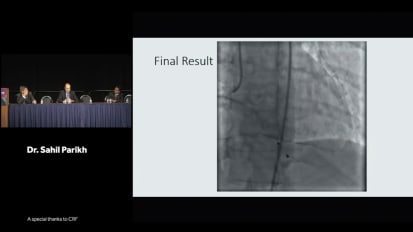 Laser practice evolution 