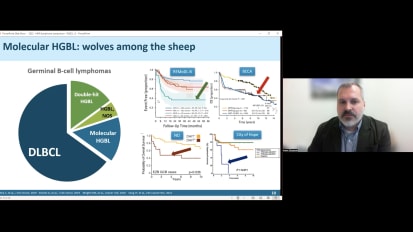 Diffuse Large B-cell Lymphoma: 22 Update