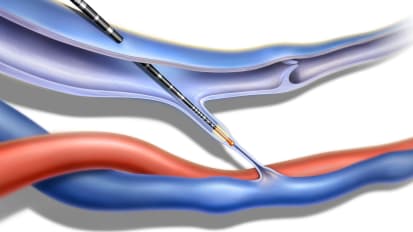 Dr. Carr Immertec Maven 