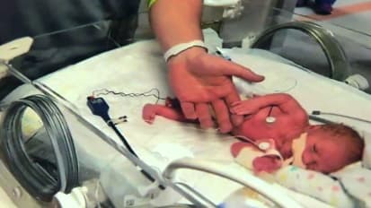 Endocarditis complicates delivery of baby 