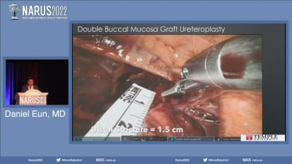 acal Mucosa Graft Ureoplasty技术指针